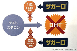 ザガーロの特徴