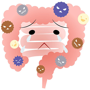 腸内フローラバランスが崩れている