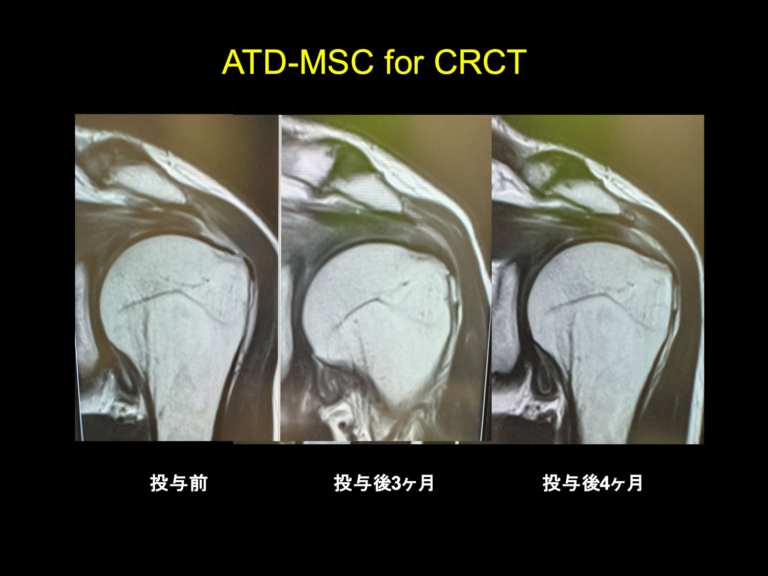 治療実績のご紹介1