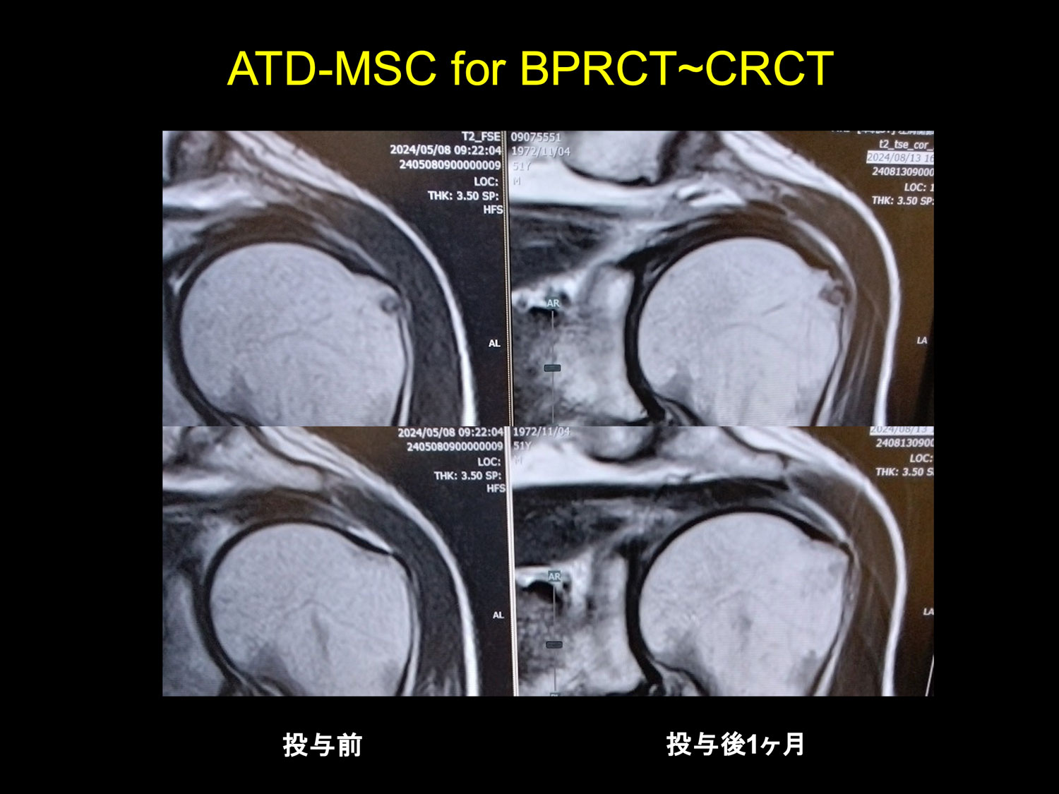 治療実績のご紹介2